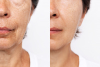 CALECIM Professional Serum 6x5ml 3